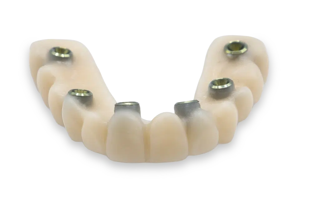 corona-provisional-sobre-implante