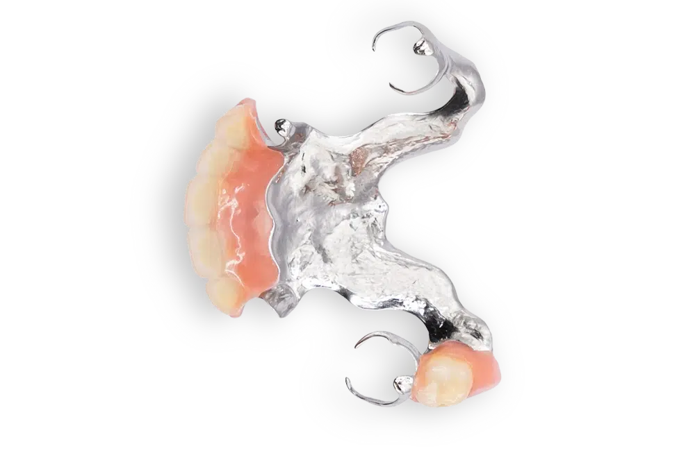 esqueletico-protesis-removible(1)
