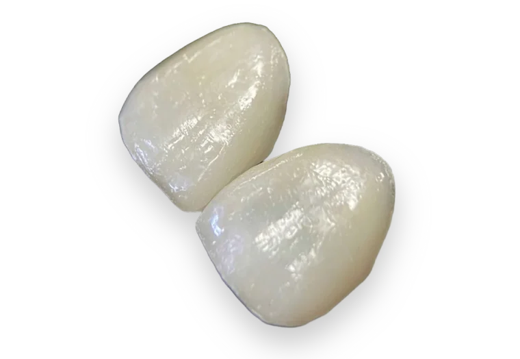 estetica-dental-carillas-disilicato-litio