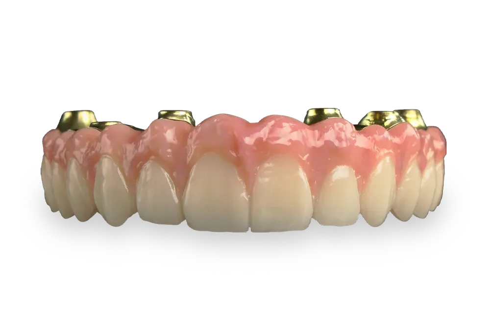 protesis-fija-tinium-dental-laboratorio