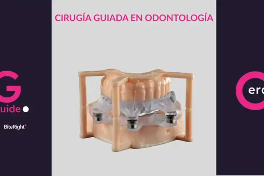 ¿Qué es la cirugía guiada en implantología?